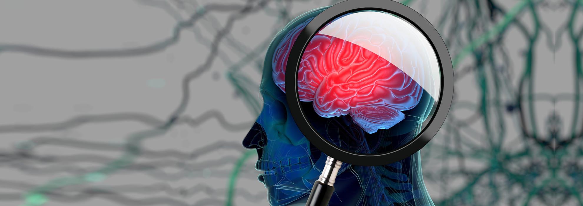 3D image of a person with a magnifying glass exposing the brain and strands in the background.